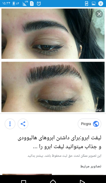 عکس لیفت ابرو نی نی سایت