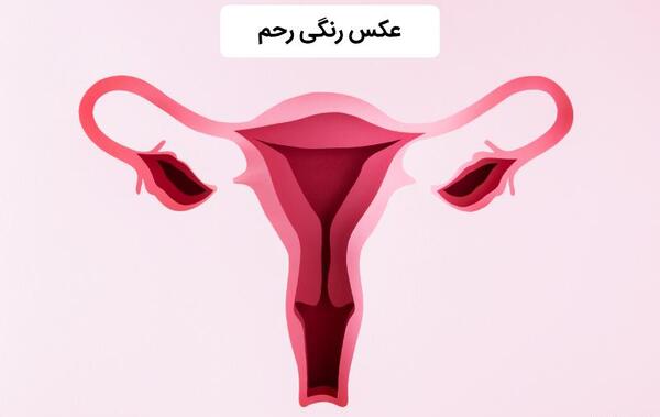 عکس رنگی درد داره نی نی سایت
