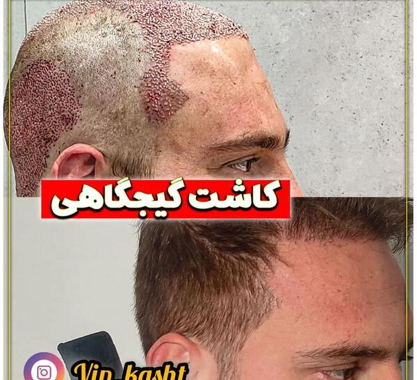 عکس چه کسانی وضعیت واتساپ را میبینند نی نی سایت