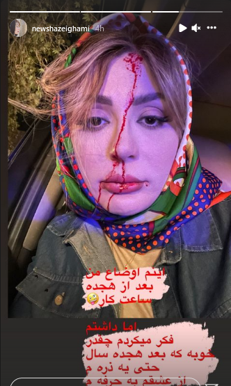 عکس استوری جدید نیوشا ضیغمی