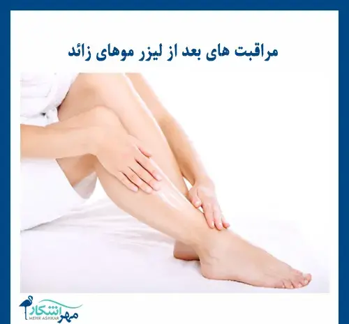 عکس های لیزر موهای زائد