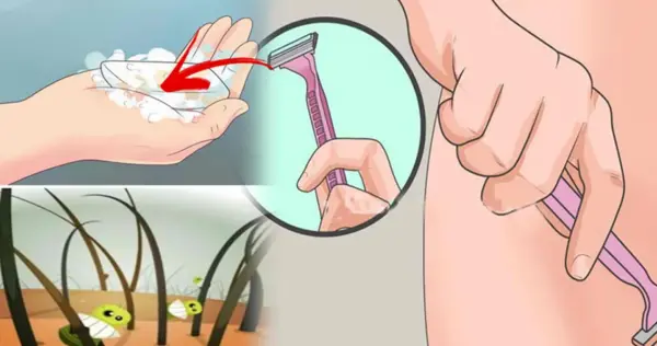 عکس لیزر موهای زائد ناحیه تناسلی زنان