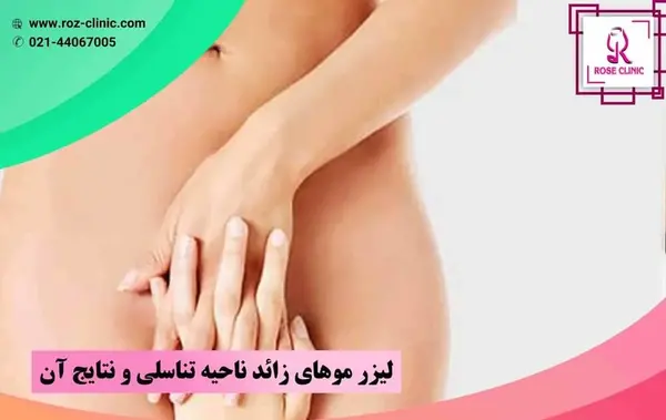 عکس لیزر موهای زائد ناحیه تناسلی زنان
