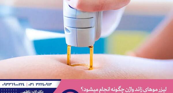عکس لیزر موهای زائد ناحیه تناسلی
