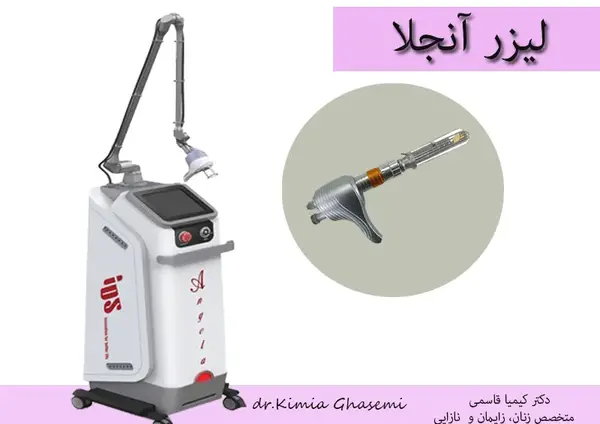 عکس لیزر مونالیزا