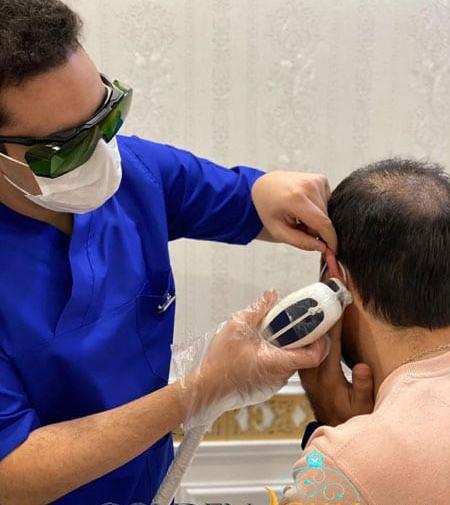 عکس لیزر موهای زائد آقایان