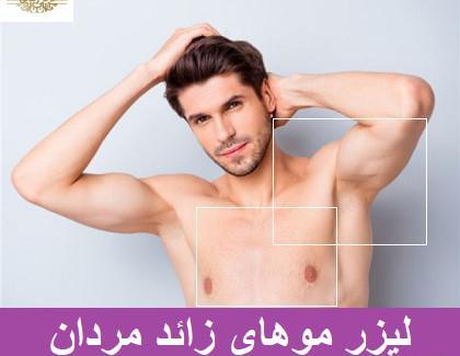 عکس لیزر موهای زائد آقایان