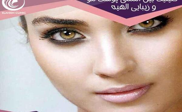 عکس پروفایل لیزر موهای زائد