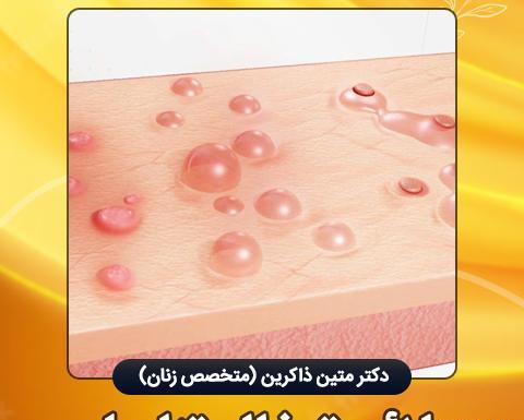 عکس ویروس تبخال تناسلی