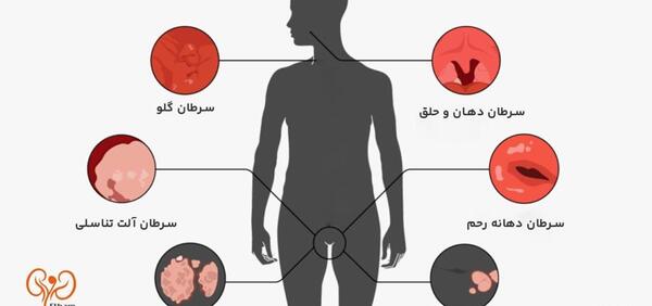 عکس ویروس اچ پی وی در مردان