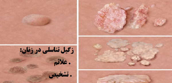 عکس ویروس اچ پی وی در مردان