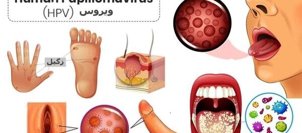 عکس ویروس اچ پی وی در زنان