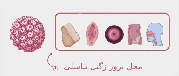 عکس ویروس اچ پی وی در زنان