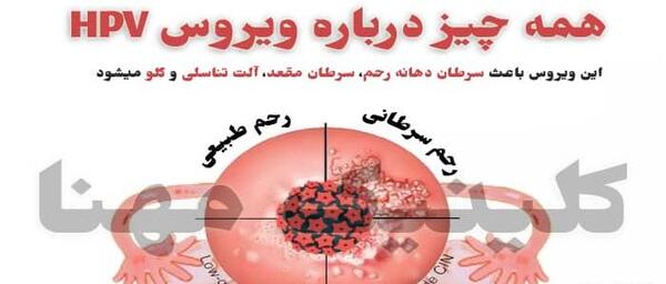 عکس ویروس اچ پی وی در زنان