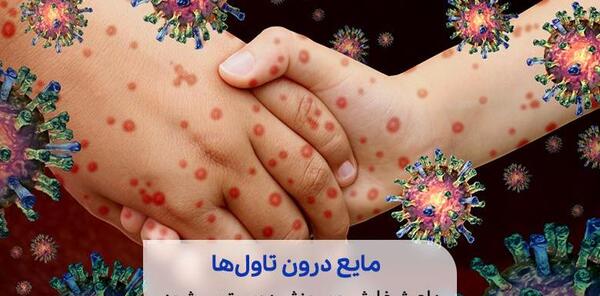عکس ویروس آبله مرغان