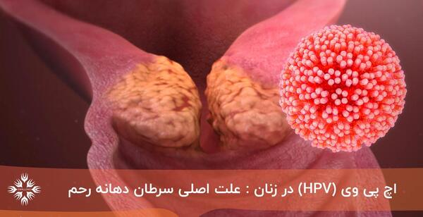 عکس ویروس اچ پی وی در دهان