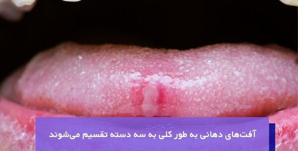 عکس ویروس اچ پی وی در دهان