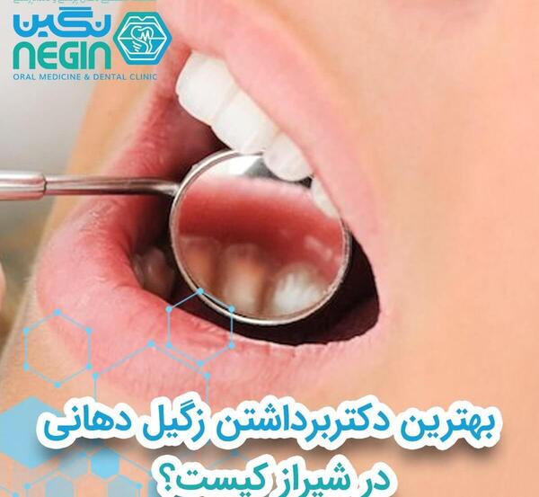 عکس ویروس اچ پی وی در دهان