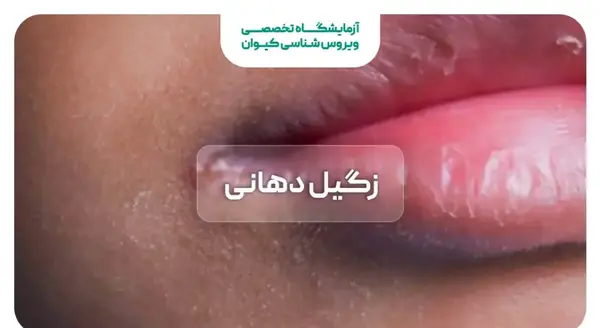 عکس ویروس اچ پی وی در دهان