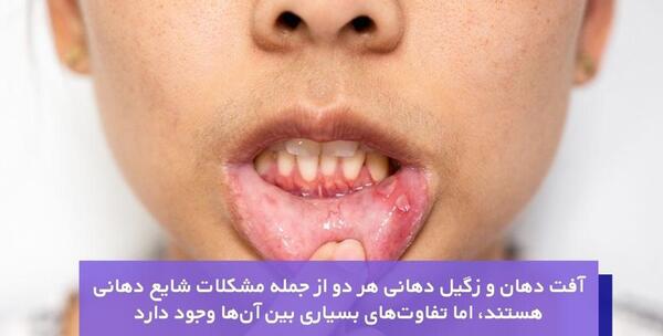 عکس ویروس اچ پی وی در دهان