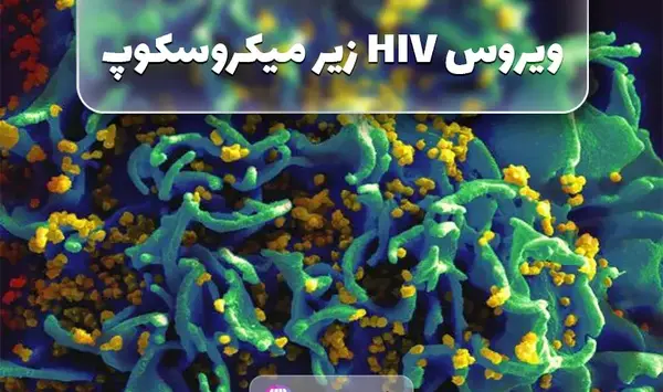 عکس از ویروس ایدز