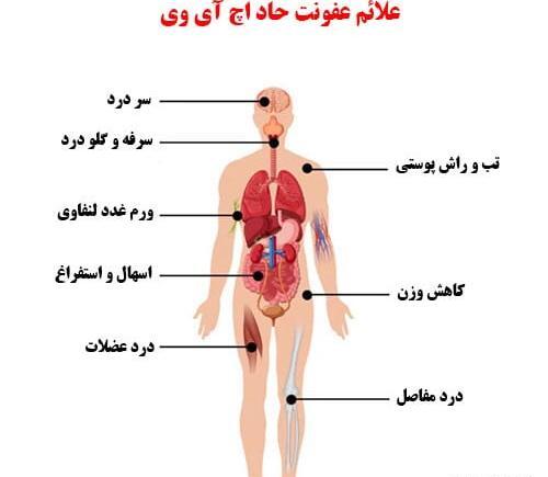 عکس از ویروس ایدز