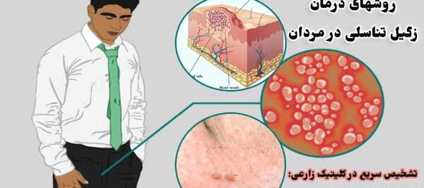 عکس های ویروس hpv