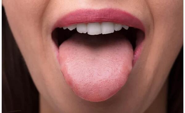 عکس ویروس hpv در دهان