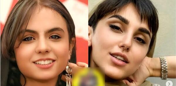 عکس های فیلم صورت زخمی