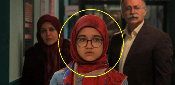 عکس صورت زخمی در فیلم بچه مهندس