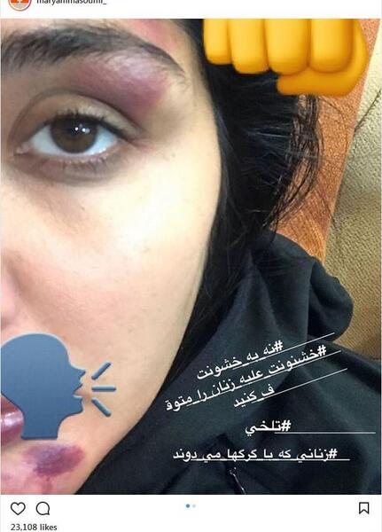عکس صورت زخمی در فیلم