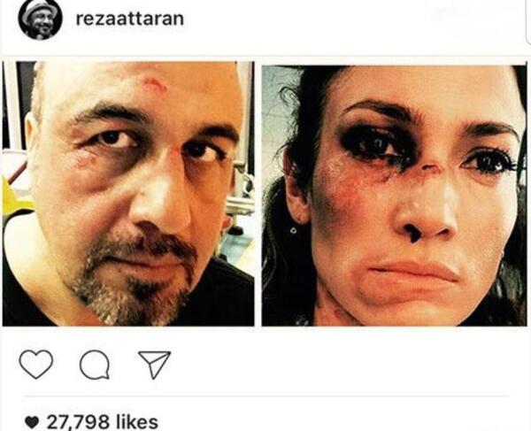 عکس صورت زخمی در فیلم