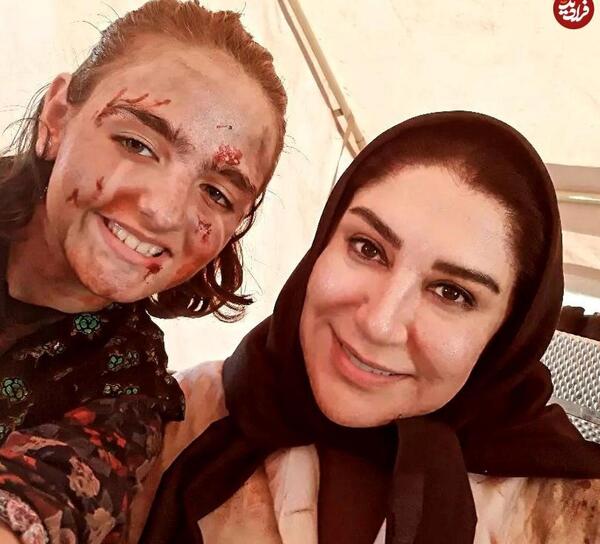 عکس صورت زخمی تو فیلم بچه مهندس