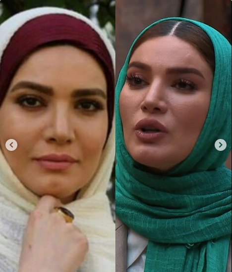 عکس بازیگر متین ستوده قبل از عمل