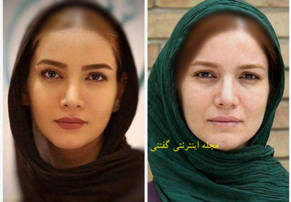 عکس بازیگر متین ستوده قبل از عمل