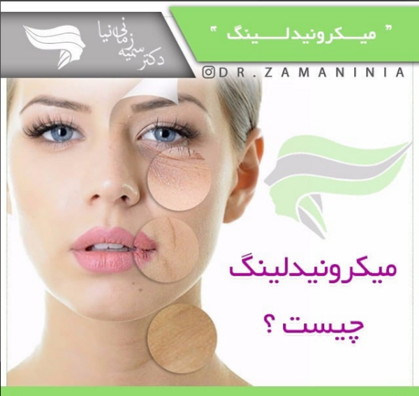 میکرونیدلینگ عکس قبل و بعد پاکسازی صورت