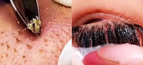 فيشيال چيست فیشیال عکس قبل و بعد پاکسازی صورت