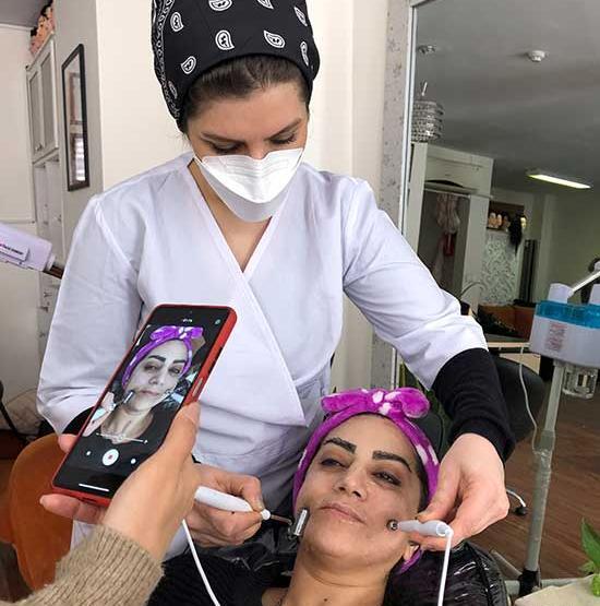 عکس های قبل و بعد پاکسازی صورت