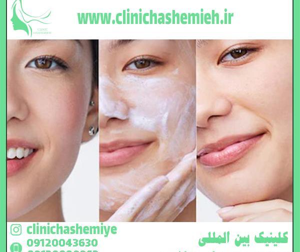 عکس های قبل و بعد پاکسازی صورت