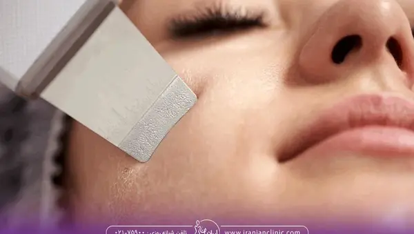 عکس های قبل و بعد پاکسازی صورت