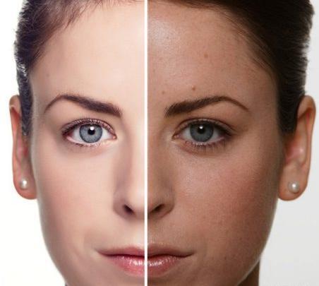 عکس های قبل و بعد پاکسازی صورت