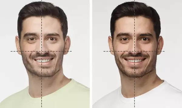عکس قبل و بعد عمل جراحی فک