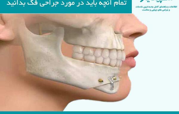 عکس قبل و بعد عمل جراحی فک