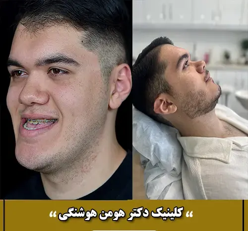 عکس قبل و بعد عمل جراحی فک