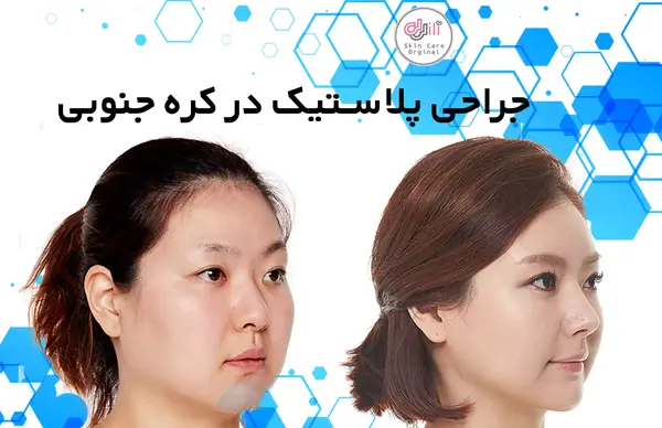 عکس های قبل و بعد جراحی فک