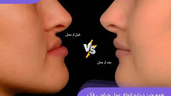 عکس های قبل و بعد از عمل جراحی فک