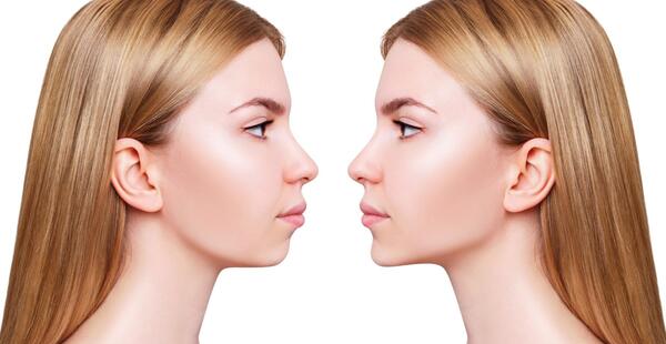عکس های قبل و بعد از عمل جراحی فک