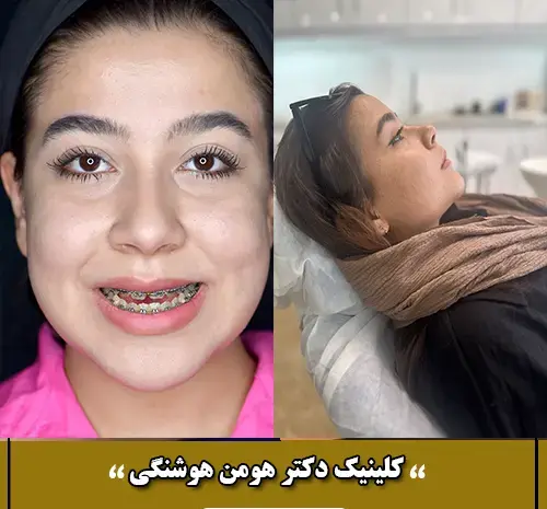 عکس های قبل و بعد از عمل جراحی فک