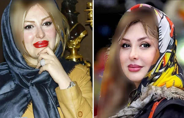 عکس های قبل عمل نیوشا ضیغمی