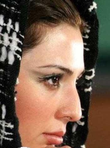 عکس های قبل عمل نیوشا ضیغمی